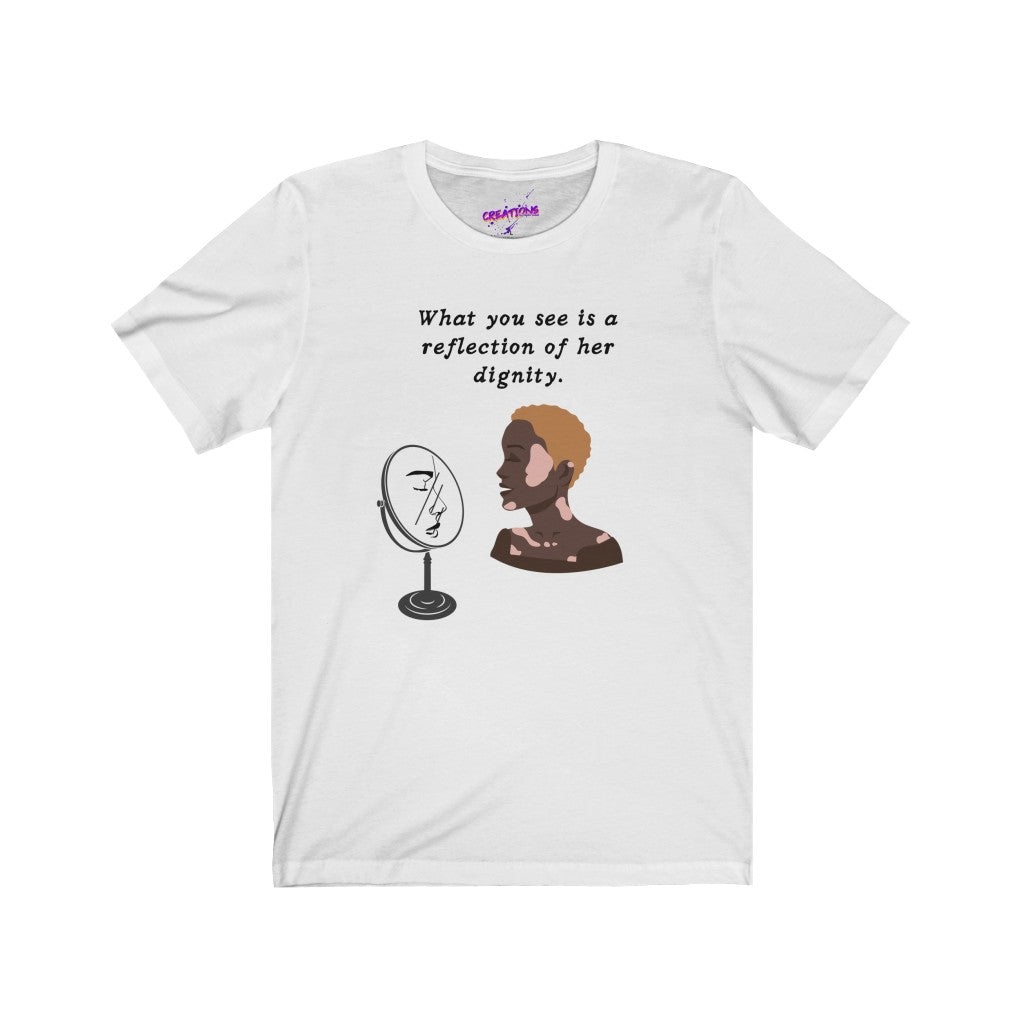 Women's Jersey Short Sleeve Tee-Authentic Beauty Vitiligo